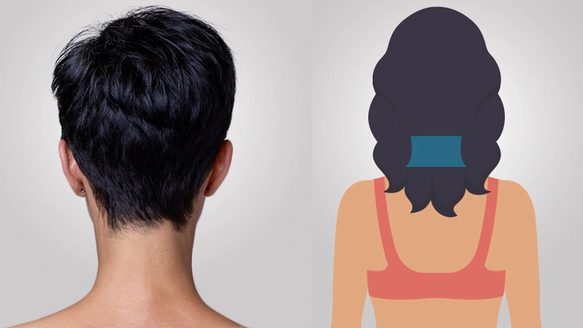 Depilação a Laser Nuca