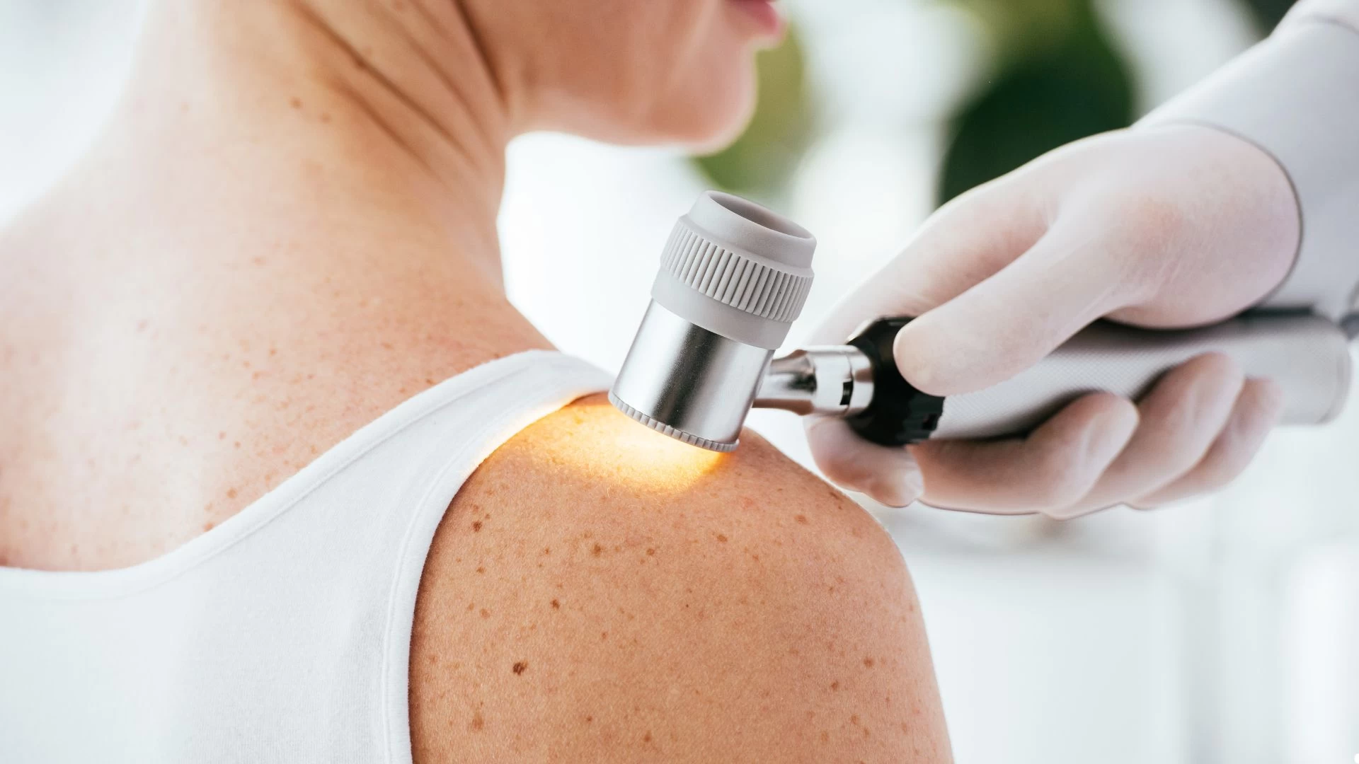 Dermatologista
